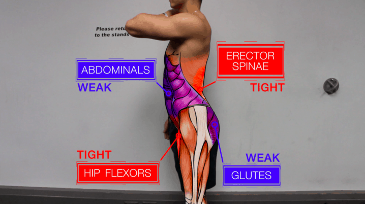 anterior pelvic tilt anatomy